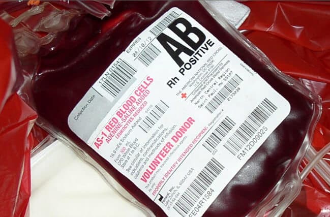 Krvna grupa AB prehrana